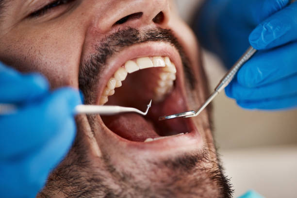 Best Emergency Tooth Extraction  in Greenville, OH