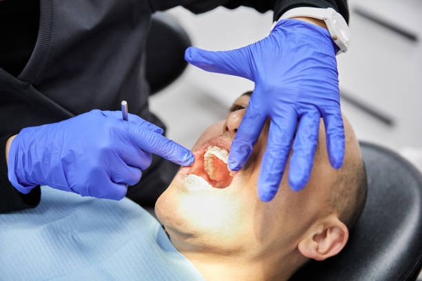 Best Chipped Tooth Repair Near Me  in Greenville, OH